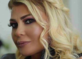 Mətanət İsgəndərlidən radikal dəyişiklik – Estetik əməliyyatdan sonra tanınmaz halda