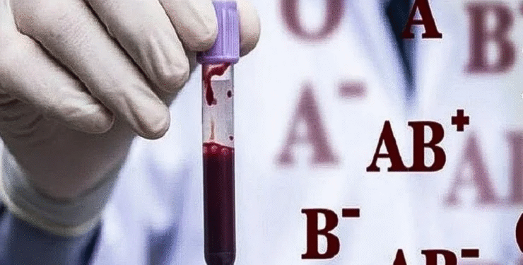 Bu qan qrupu olanlar diqqətli olsun: Beyin insultu riski daha yüksəkdir