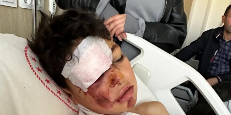 Minik avtomobili və velosiped toqquşdu: 12 yaşlı uşaq yaralandı