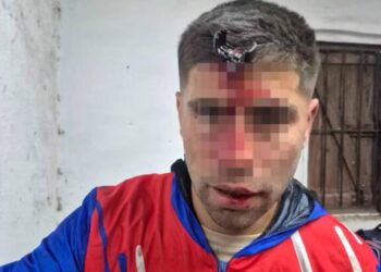 Açarla döydülər, alnında ilişib qaldı