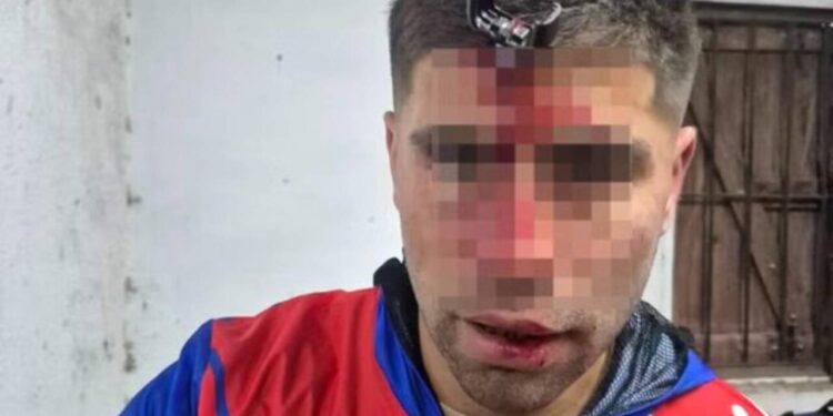 Açarla döydülər, alnında ilişib qaldı