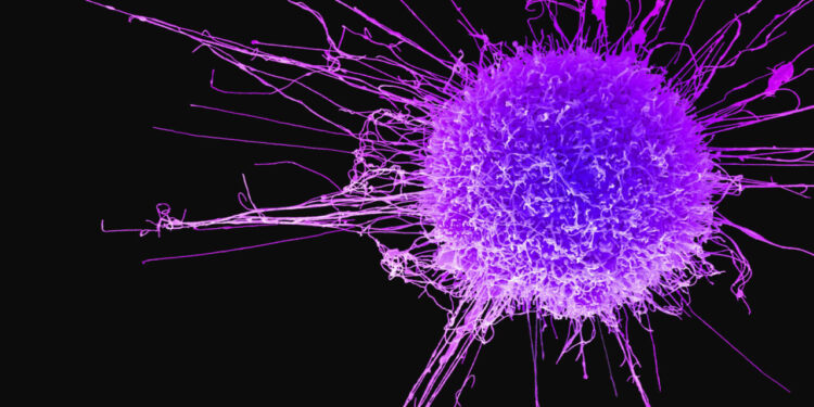 3 həftədən çox davam edən öskürək bu ölümcül xəstəliyin xəbərçisidir