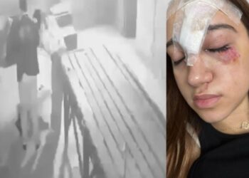 Bakıda qorxu evinə gedən 15 yaşlı qız xəsarət aldı – Alnına 11 tikiş qoyuldu