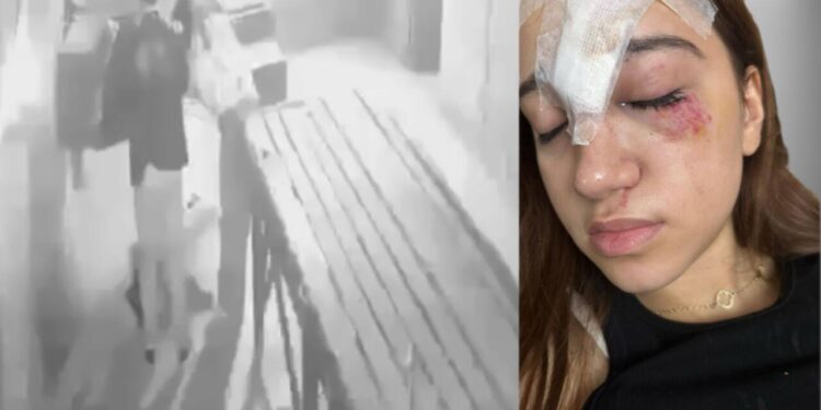 Bakıda qorxu evinə gedən 15 yaşlı qız xəsarət aldı - Alnına 11 tikiş qoyuldu