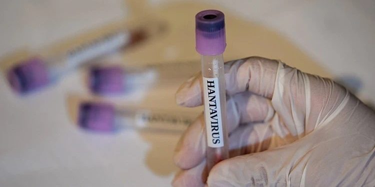 “Hantavirus” Avropada yayılır