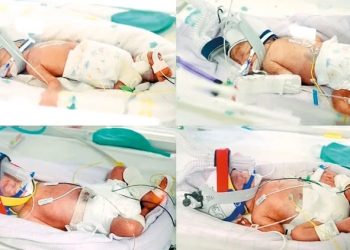 Avstraliyada nadir dördəm doğuldu