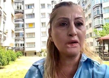 Antalyada gözəlləşmək istəyən qadını görün nə günə saldılar -FOTOLAR