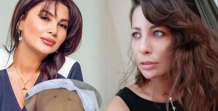 Aktrisaya görə Ülviyyə İlyasovanın cəzası artırıldı
